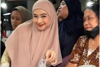 Ria Ricis: Alasan Operasi Hidung dan Reaksi Publik