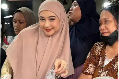 Ria Ricis: Alasan Operasi Hidung dan Reaksi Publik