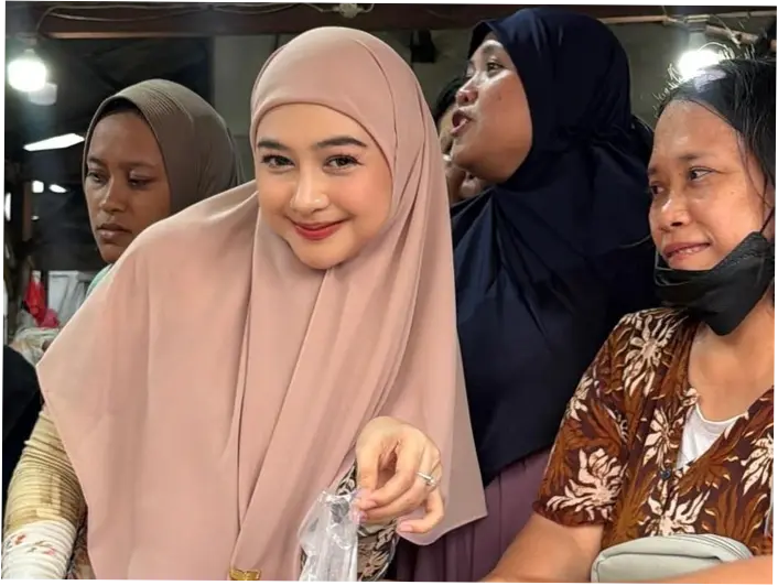 Ria Ricis: Alasan Operasi Hidung dan Reaksi Publik